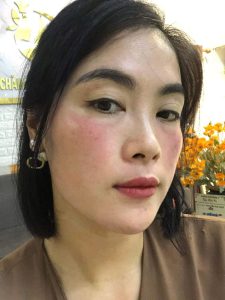 Tế bào gốc đông khô ZIKII giúp kích thích sản sinh tế bào da mới , giúp da phục hồi nhanh chóng